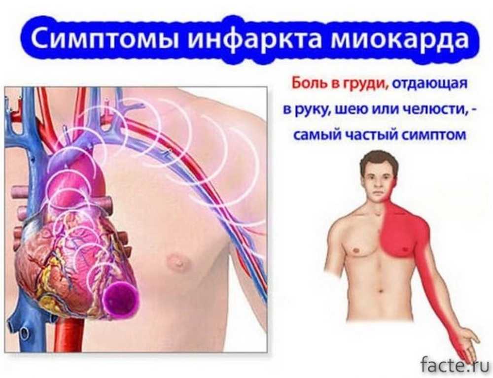 Где находится сердце у женщины фото и как болит показать в картинках