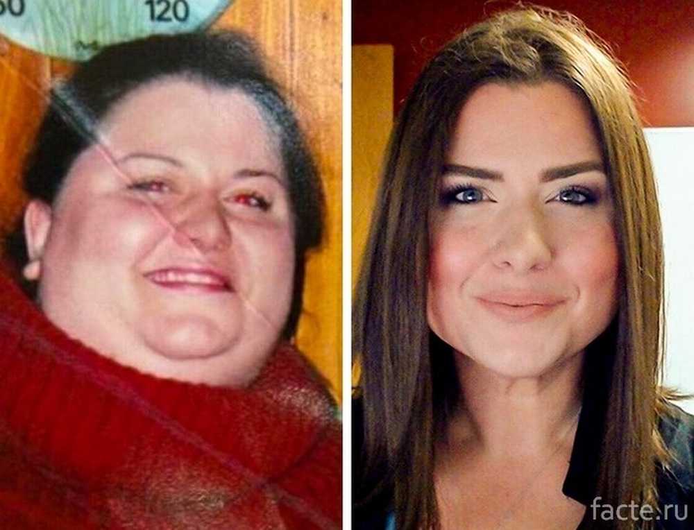 Очень сильно изменился. Лицо после похудения. Лицо до и после похудения. Лица людей до и после похудения. Меняется лицо после похудения.