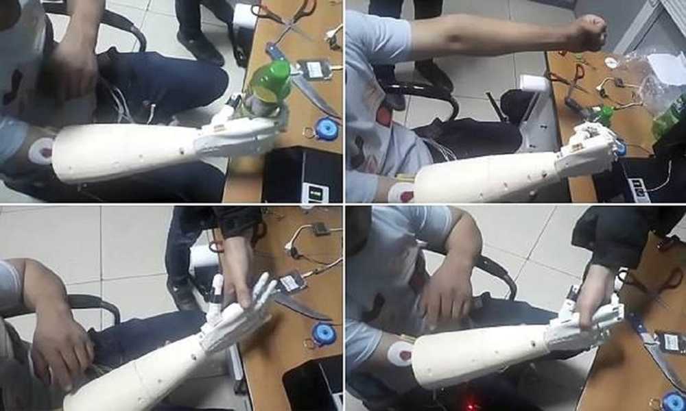 Нейробионика протезы. Как работают протезы. Джесси салливан бионические протезы. Как работают бионические протезы. Бионический протез ступни.