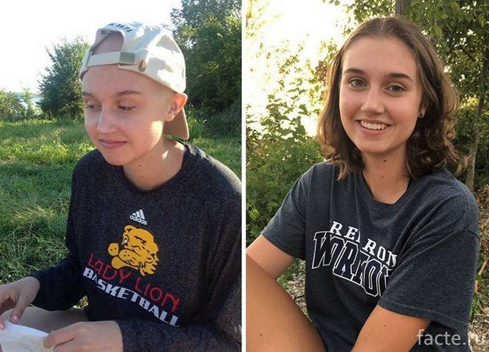 пятилетняя выживаемость. выжили после нового года картинки. фото пациента красавца. выживаем после рака. выживаем после рака.